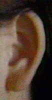 pmdd ear