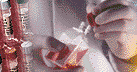 premenstrual syndrome cell culture